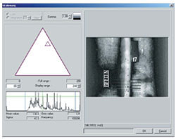 Digitales Röntgen-Bildverarbeitungssystem Y.IMAGE 3500-DD